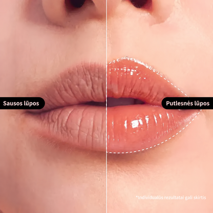 NIDA lūpų serumas su retinoliu Rosy Fig